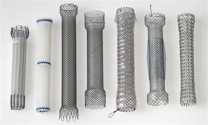 Are esophageal stents permanent?