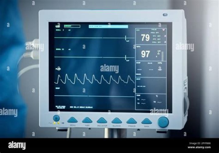 Are heart rate monitoring?