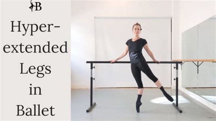 Are hyperextended knees good for ballet?