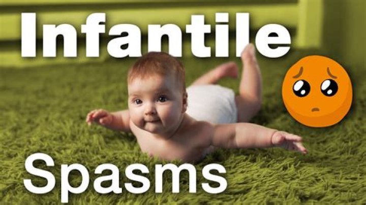 Are infantile spasms normal?