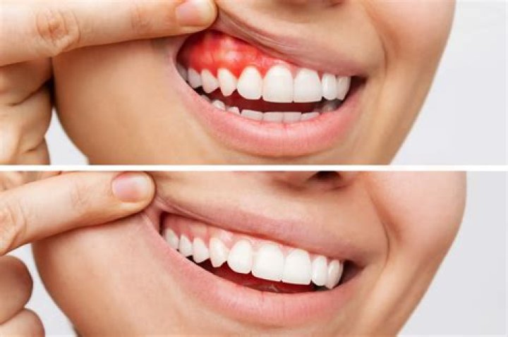 Are inflamed gums bad?