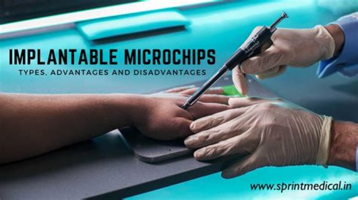 Are microchips being implanted in humans?