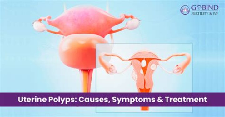 Are uterine polyps cancerous?