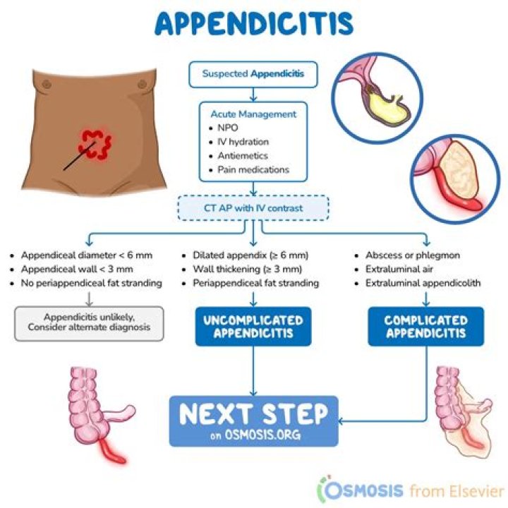At what age can you get appendicitis?