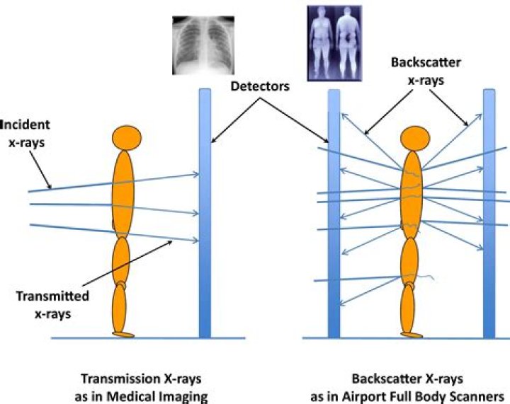 Can backscatter see inside body?