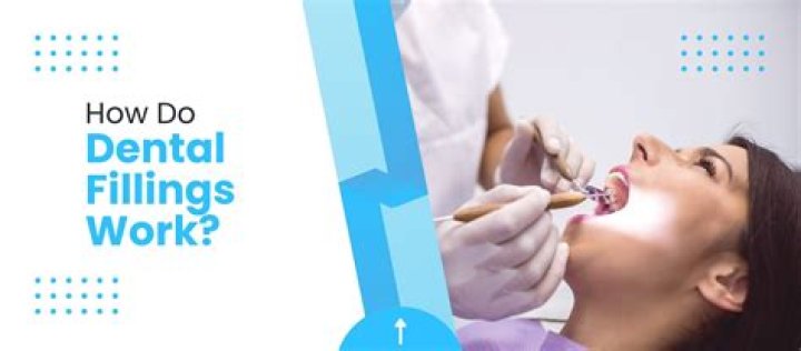 Can dentists do fillings?