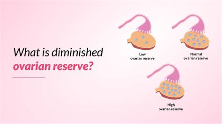 Can diminished ovarian reserve cause miscarriage?