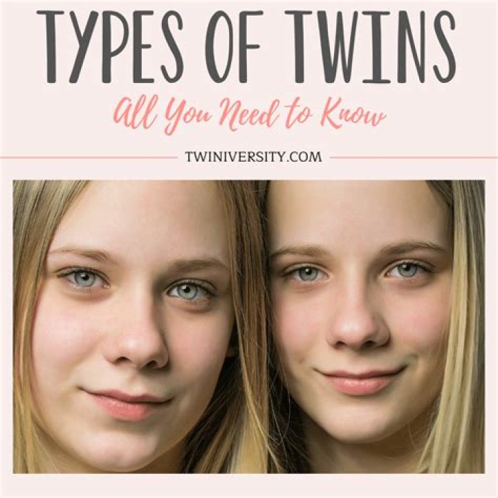 Can identical twins have different facial features?