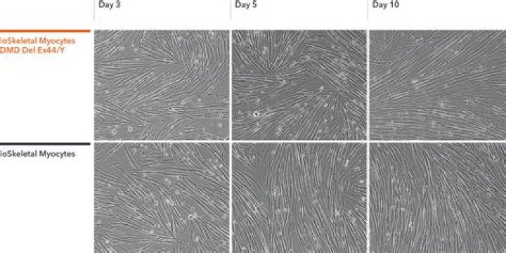 Can skeletal myocytes undergo mitosis?