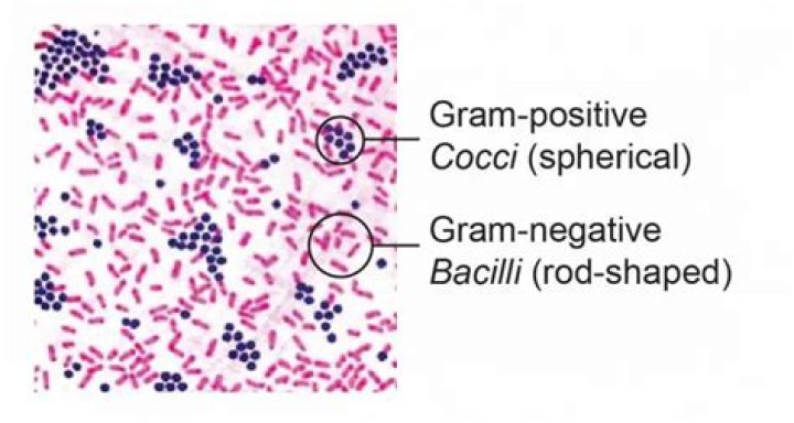 Can streptobacillus be gram positive?