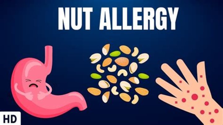 Can you be allergic to kukui nut?