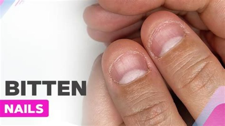 Can you die from biting your nails?