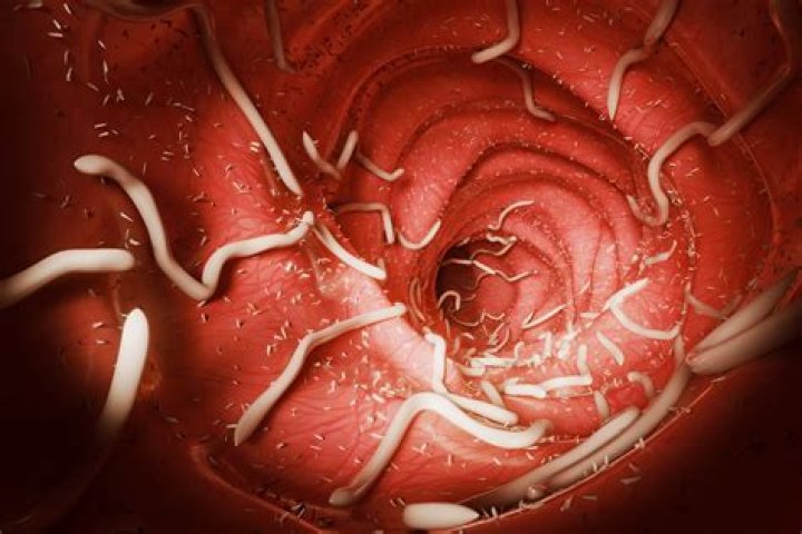 Can you feel ascariasis?