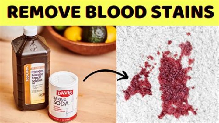 Can you remove dried blood stains?