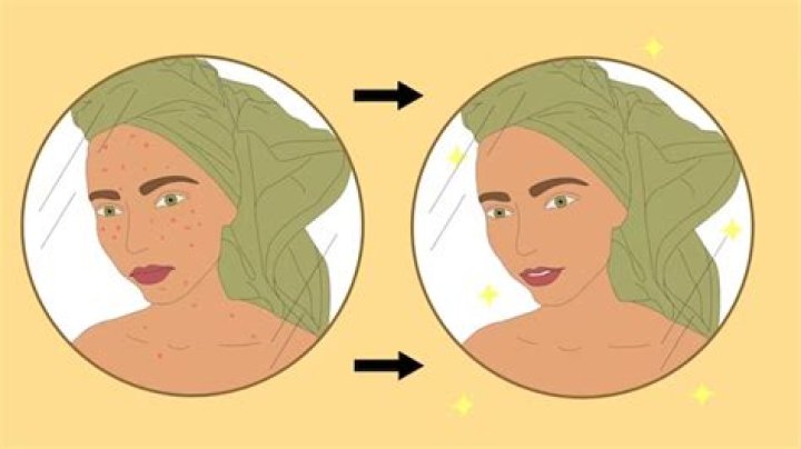 Could low iron cause acne?