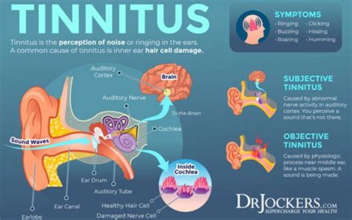 Could tinnitus be cured?