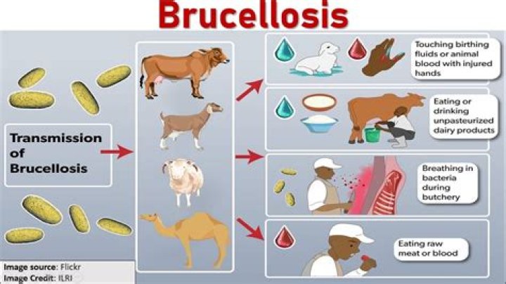 Did florence nightingale have brucellosis?