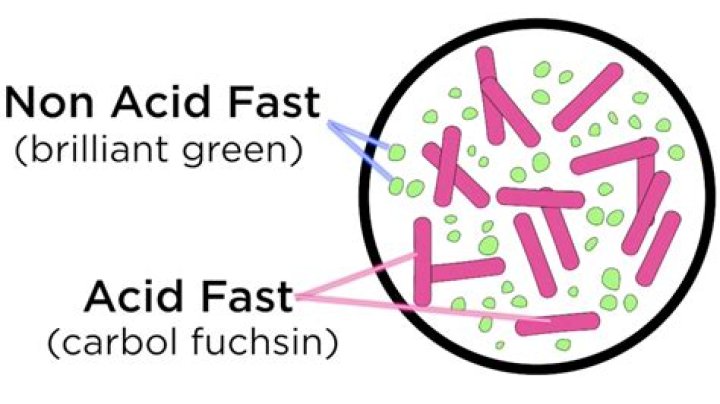Did the acid fast stain sputum?