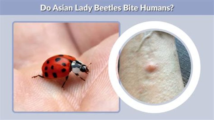 Do asian beetles bite?