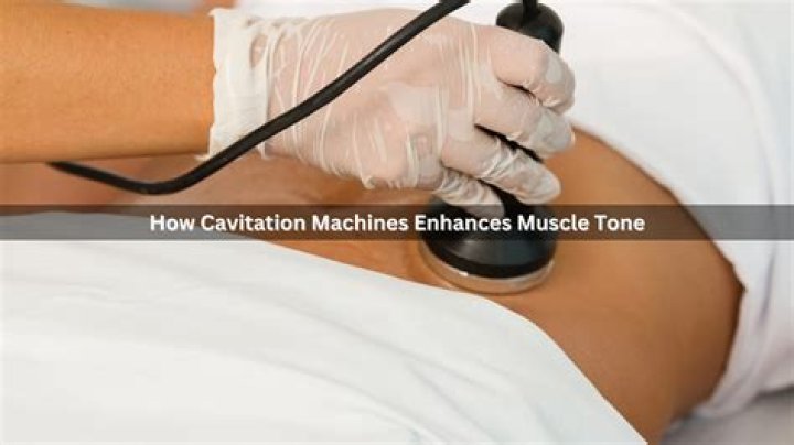 Do cavitation machines work?