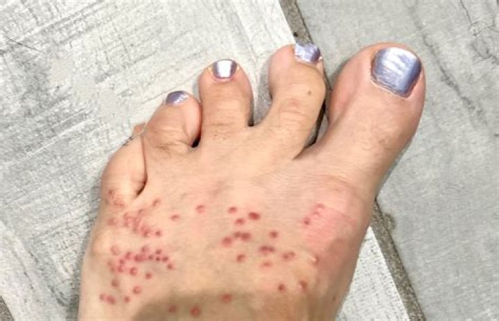 Do chiggers lay eggs?