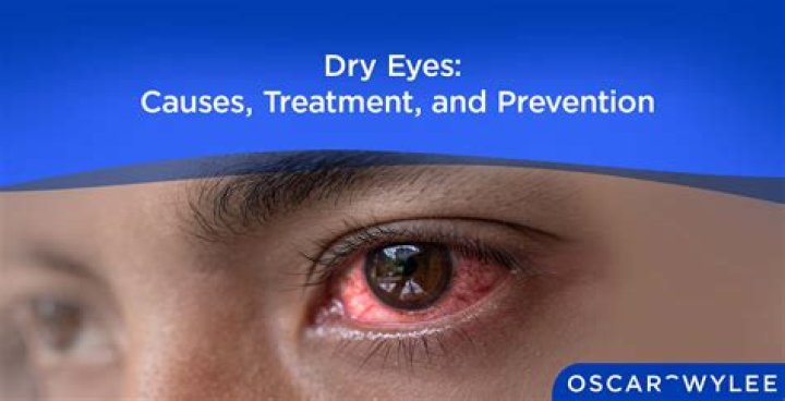 Do dry eyes cause itching?