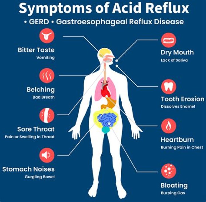 Do fodmaps cause acid reflux?