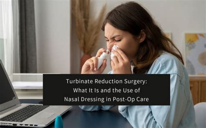 Do i need turbinate reduction?
