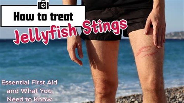 Do jellyfish sting through clothing?