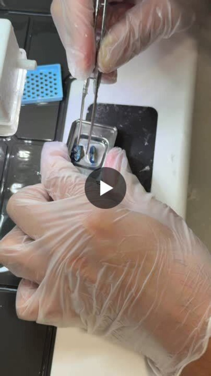 Do we stain specimens?