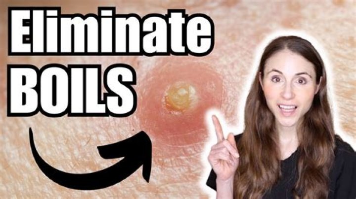 Does chafing cause boils?