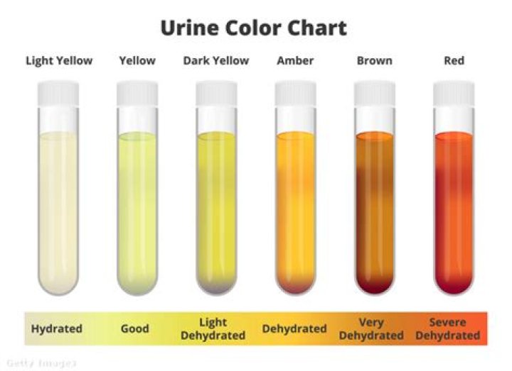 Does color of urine mean anything?