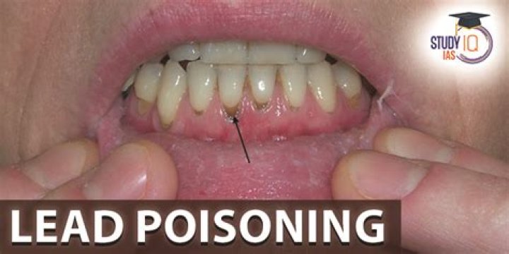 Does crayons have lead poisoning?