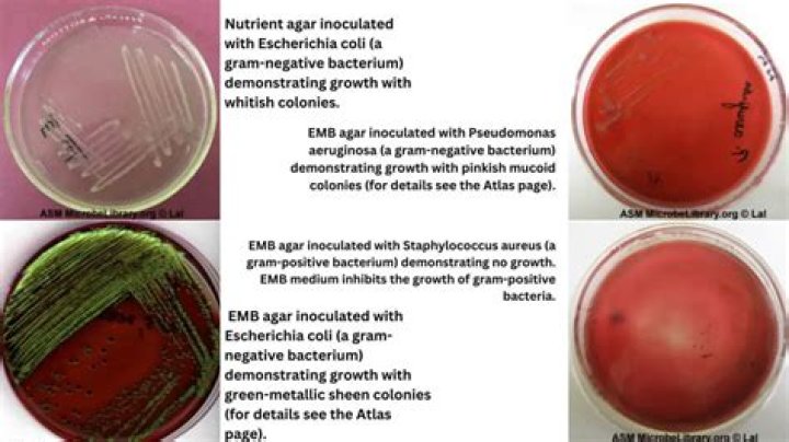 Does enterobacter aerogenes ferment glucose?