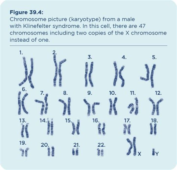 Does karyotype show genetic disorders?
