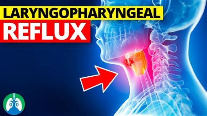 Does laryngopharyngeal reflux ever go away?
