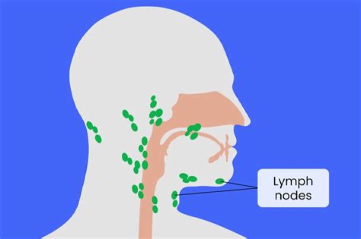 Does pharyngitis cause swollen lymph nodes?