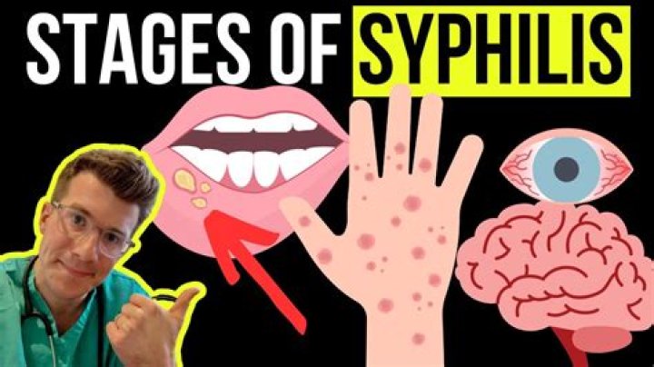 Does syphilis come and go?