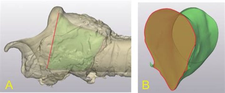 Does the epiglottis protect the rima glottidis?
