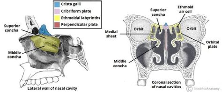 Does the ethmoid bone contains the crista galli?