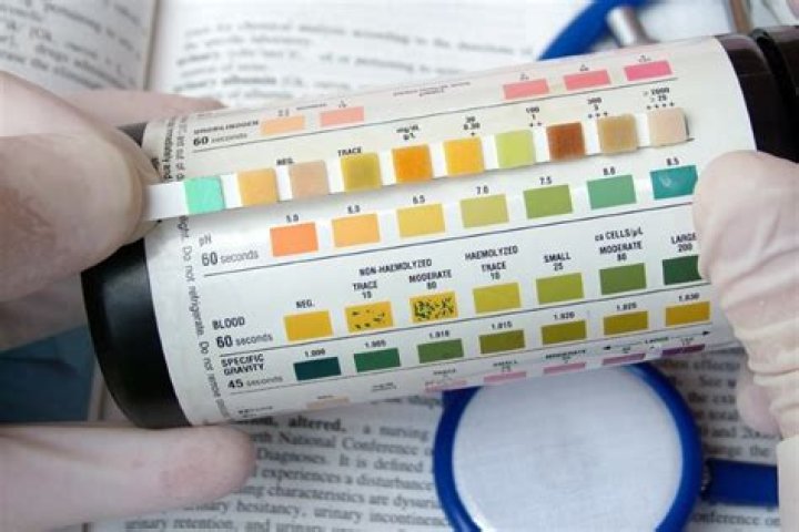 Does the military test for alcohol in the urinalysis?
