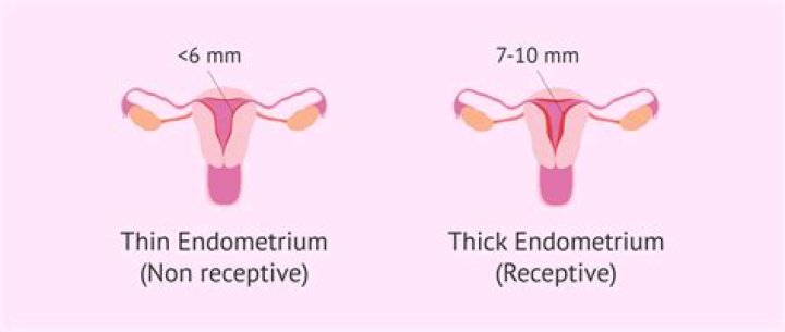 Does thickened endometrium mean cancer?