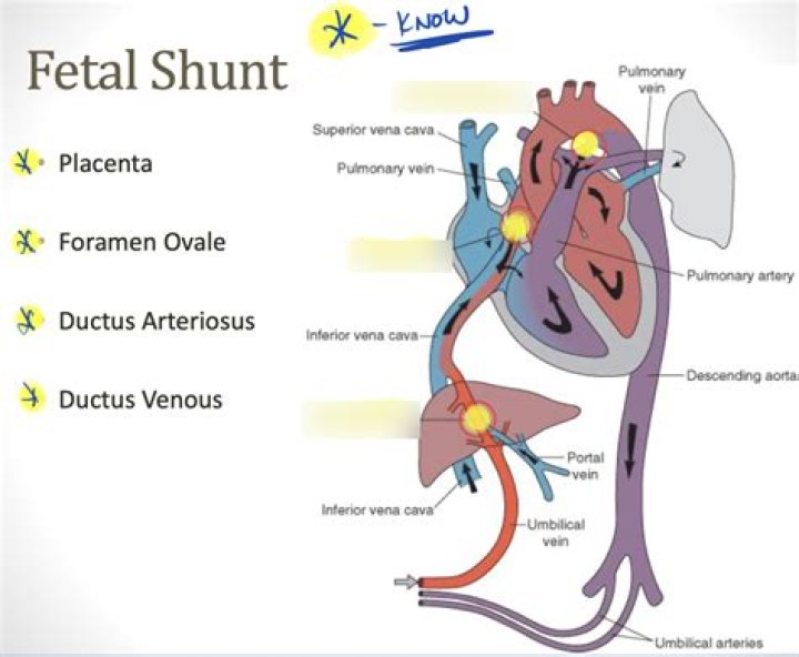 For a shunt meaning?
