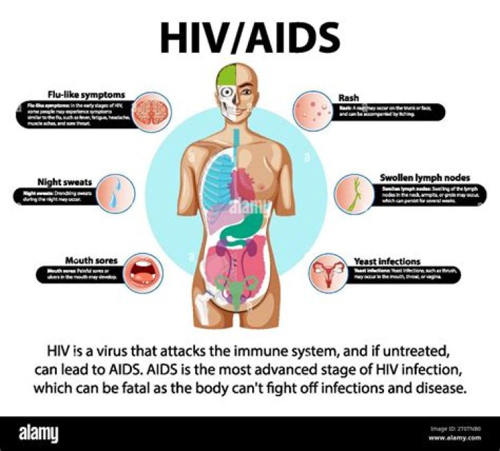 How aids is formed?