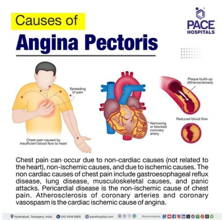 How angina pectoris is treated?