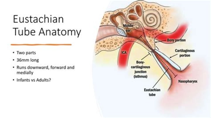 How common is patulous eustachian tube?