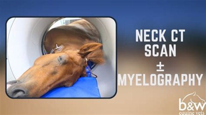 How do you do a myelography?