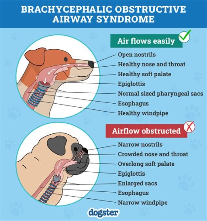 How does unconsciousness affect airway?