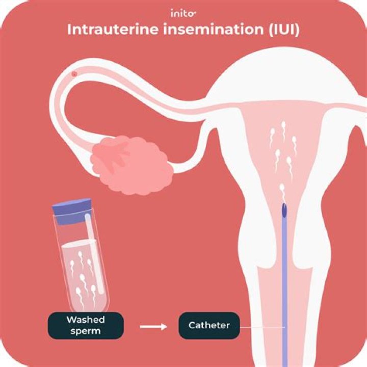 How much do artificial insemination make?