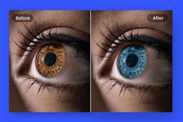 How much does changing your eye color cost?